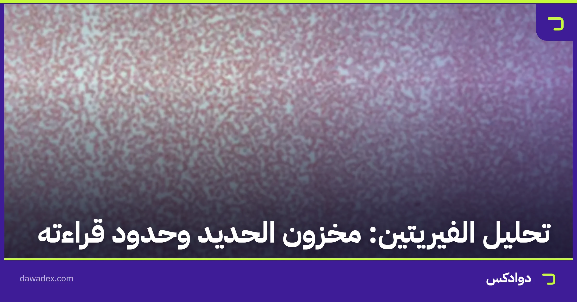 تحليل الفيريتين: مخزون الحديد وحدود قراءته